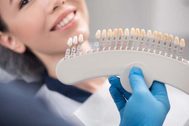 Composite Veneers vs Porcelain Veneers: Which Should You Choose?