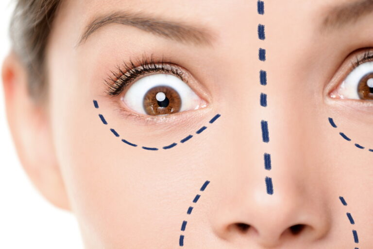 Bad Botox: Expected Side Effects and Unwanted Reactions