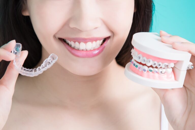 Teeth Straightening Methods: Invisalign vs. Braces