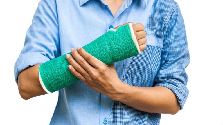 What to Expect When Getting a Total Contact Cast for Wound Treatment