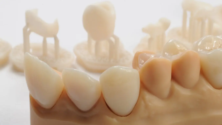 3-D Printed Dental Crowns: Dentistry’s Laurels