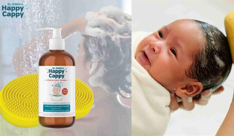 Best Shampoo For Cradle Cap in Infants