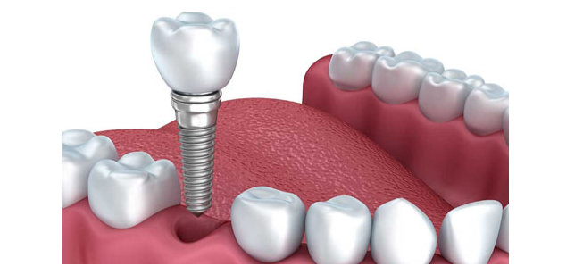 dental 1
