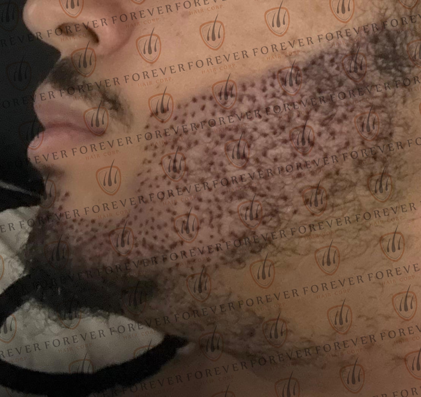 111