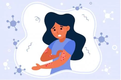 Best Natural Treatment for Molluscum That Actually Works