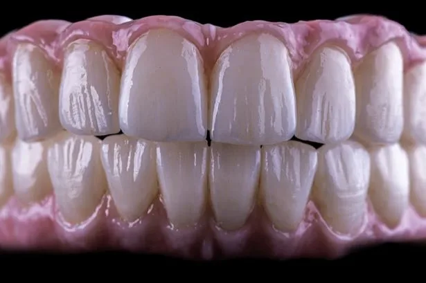 Why ALLONUS Is Transforming Full-Arch Dental Implants in Houston