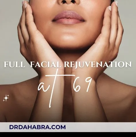 Radiant Full Facial Rejuvenation at 69: Transformative Filler & Botox
