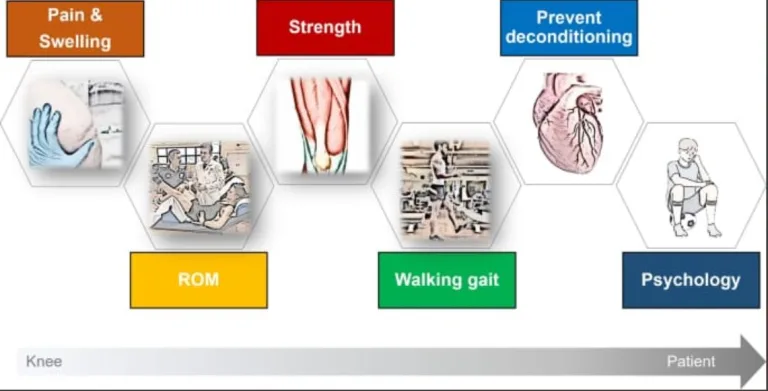 Optimizing Post-ACL Reconstruction Rehab: From Milestones to Return-to-Play