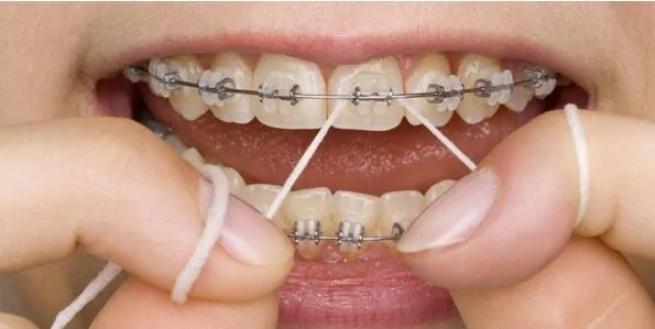 Reimagining Smiles: How Imagine Orthodontic Studio is Transforming Orthodontic Care in Tampa, FL