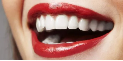 Why People in the US Are Turning to Veneers in the Dominican Republic
