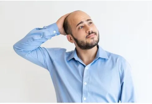 How to Stop Male Pattern Hair Loss Before It’s Too Late