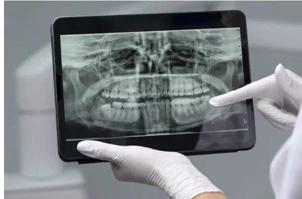 Korean Implant Hospital Recommand for Trusted Dental Care