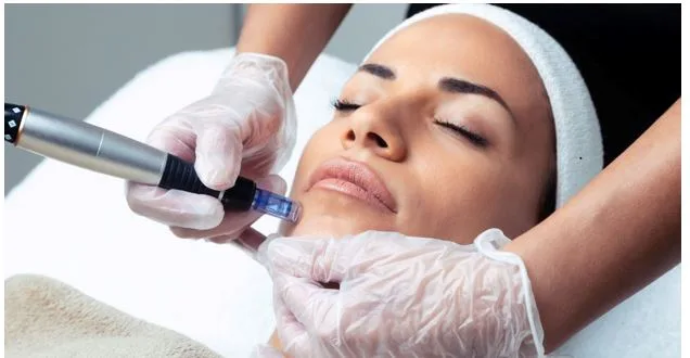 Microneedling PRP Explained: Natural Skin Regeneration Using Your Own Plasma