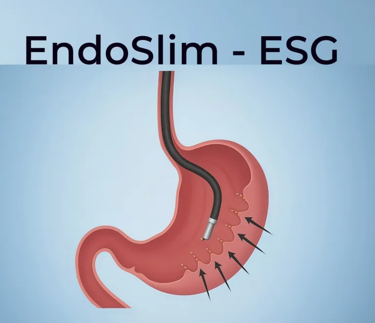 Expert in ESG Stomach Tightening & Gastric Balloon Procedures