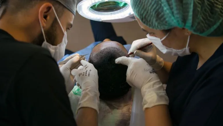 Understanding Hair Transplantation