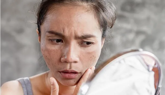 Chapped, Cracked, or Just Confused? Let’s Decode Autumn Skin