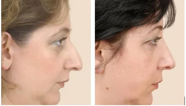 Europe’s Rising Hub for Affordable Aesthetic Surgery: Why Albania Is on the Global Map