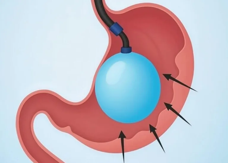 EndoSlim Clinic NY — The New Leader in the Modern Weight-Loss Industry