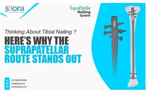 Thinking About Tibial Nailing ? Here’s Why the Suprapatellar Route Stands Out