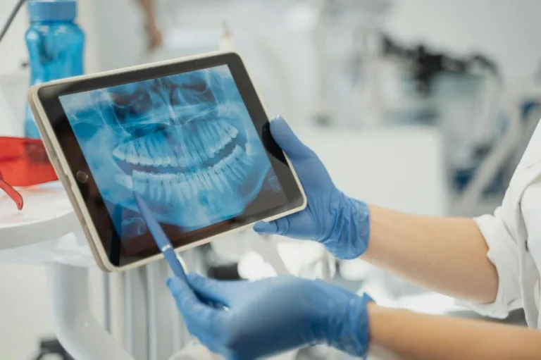 The Rise of Digital Dentistry: Innovations Changing Patient Care