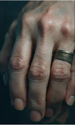 Why Do My Fingers Look Wrinkled When Not in Water? The Science Explained