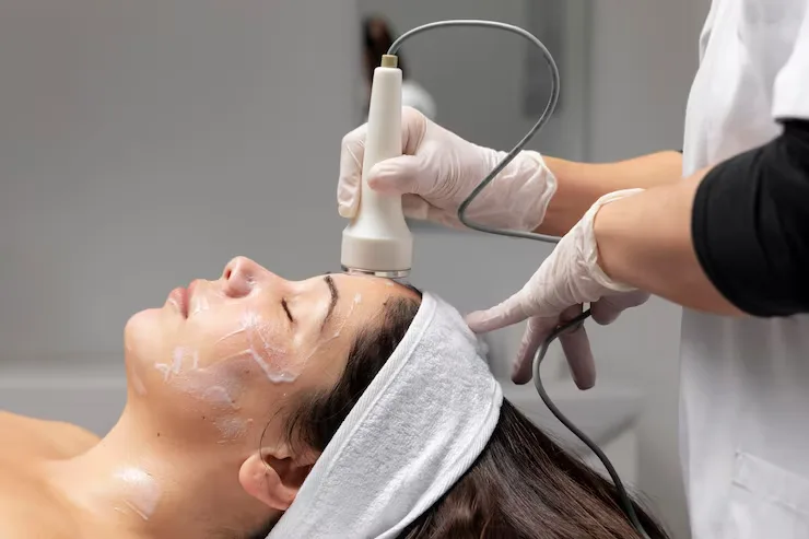 Unlock Youthful Skin with Thermage: The Revolutionary Skin Tightening Treatment