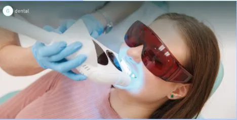 Teeth Whitening Greensborough: Professional vs At-Home Whitening Explained