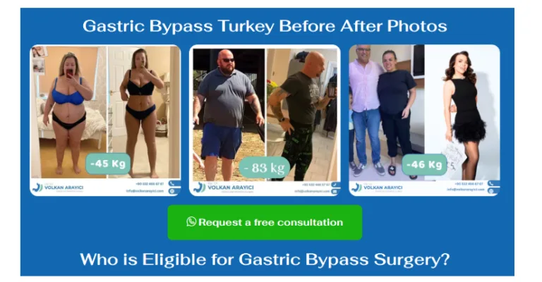 Affordable Gastric Sleeve Surgery in Turkey: What You Need to Know