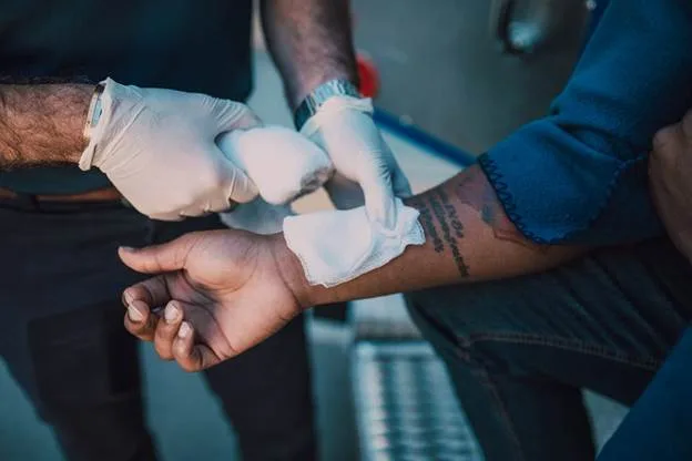 Treating Minor Burns at Home: A Quick Guide to Burn Injury Aftercare
