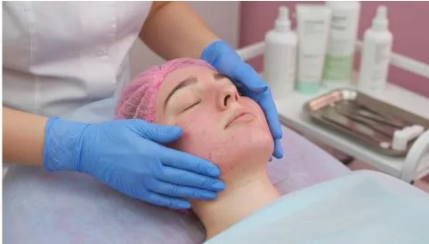 The Atomic Dermatology Guide to Rosacea Treatment in Walla Walla (Your 2026 Action Plan)