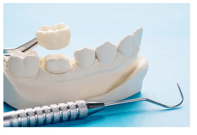 Fixed Prosthodontics Is Redefining Precision Dentistry Through Digital Innovation