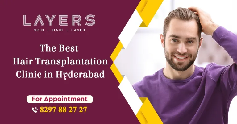 Hair Transplant in Hyderabad: What to Expect Before, During, and After the Procedure