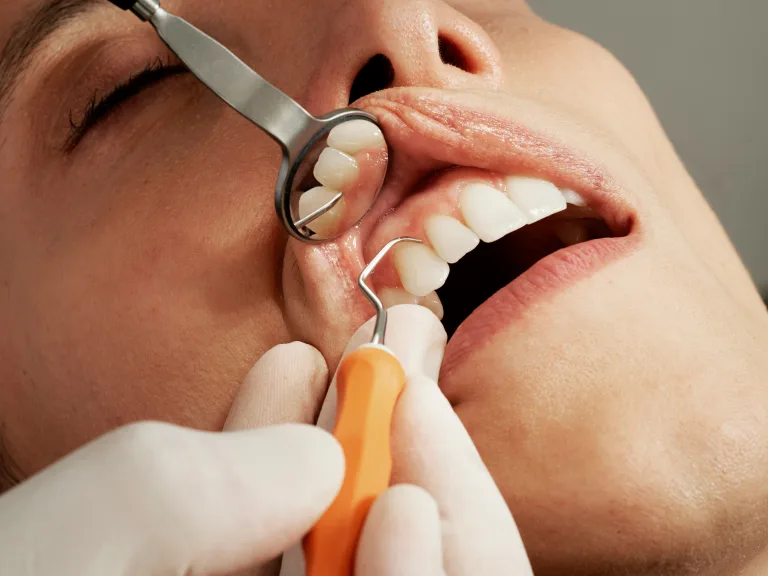 Dental Care Tips to Follow After a Cosmetic Dentistry Procedure