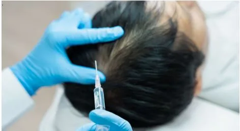 Best Hair Tonic in Singapore: Separating Real Ingredients From Marketing Claims